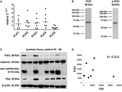 Inhibition of Prostate Smooth Muscle Contraction by Inhibitors of Polo-Like Kinases